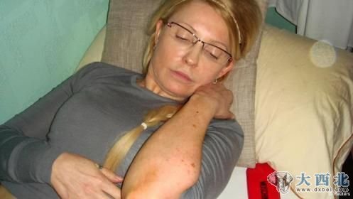 季莫申科称在狱中遭暴力对待，并展示她身上的瘀伤。