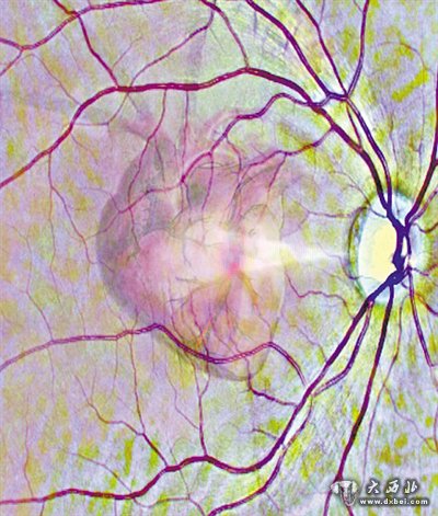 扫描视网膜，AI可知心脏病风险